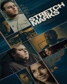 Stretch Marks (2018) Free Download